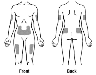 Front and back view of human body with potential injection areas indicated.