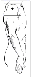 Figure 15 shows a site for intramuscular injection on the upper arm